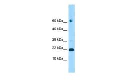 ADAT2 Rabbit anti-Human, Polyclonal, Novus Biologicals 0.1 mL | Buy Online | Novus Biologicals | Fisher Scientific